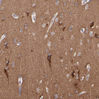 Immunohistochemical staining of human cerebral cortex shows strong positivity in neuropil.