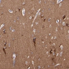 Immunohistochemical staining of human cerebral cortex shows strong positivity in neuropil.