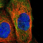 Immunofluorescent staining of human cell line A-431 shows localization to cytosol.