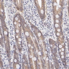 Anti-PBDC1 Antibody