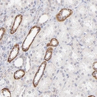 Immunohistochemical staining of human kidney shows strong cytoplasmic positivity in cells in tubules.
