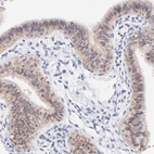 Immunohistochemical staining of human Fallopian tube shows weak cytoplasmic positivity in glandular cells.