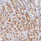 Immunohistochemical staining of human stomach shows moderate cytoplasmic positivity in glandular cells.