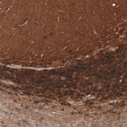 Immunohistochemical staining of human cerebellum shows moderate cytoplasmic/ membranous positivity in cells in granular layer.