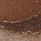Immunohistochemical staining of human cerebellum shows moderate cytoplasmic/ membranous positivity in cells in granular layer.