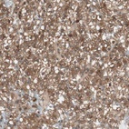 Anti-ATP6AP2 Antibody