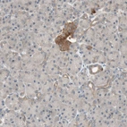 Immunohistochemical staining of human pancreas shows moderate cytoplasmic positivity in islets of Langerhans.