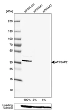 Western blot analysis in HEK293 cells transfected with control siRNA, target specific siRNA probe #1 and #2, using Anti-ATP6AP2 antibody. Remaining relative intensity is presented. Loading control: Anti-PPIB.