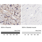 Anti-BGN Antibody