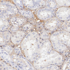 Immunohistochemical staining of human kidney shows moderate extracellular space positivity.