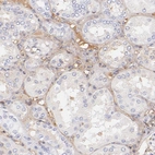 Immunohistochemical staining of human kidney shows moderate extracellular space positivity.