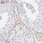 Immunohistochemical staining of human testis shows weak to moderate cytoplasmic positivity in peritubular myoid cells.