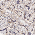 Immunohistochemical staining of human placenta shows moderate cytoplasmic positivity in trophoblastic cells.
