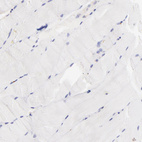 Anti-BGN Antibody