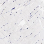 Immunohistochemical staining of human skeletal muscle shows no positivity in myocytes as expected.
