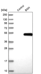 Western blot analysis in control (vector only transfected HEK293T lysate) and BGN over-expression lysate (Co-expressed with a C-terminal myc-DDK tag (~3.1 kDa) in mammalian HEK293T cells, LY400642).