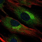 Immunofluorescent staining of human cell line BJ shows localization to endoplasmic reticulum & the Golgi apparatus.