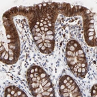 Immunohistochemical staining of human colon shows strong cytoplasmic and nuclear positivity in glandular cells.