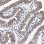 Anti-LGALS3 Antibody