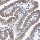 Immunohistochemical staining of human fallopian tube shows moderate cytoplasmic positivity in glandular cells.