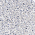 Immunohistochemical staining of human liver shows no positivity in hepatocytes as expected.