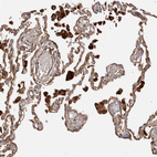 Anti-GTPBP1 Antibody