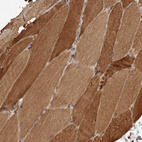 Immunohistochemical staining of human skeletal muscle shows moderate cytoplasmic positivity in myocytes.