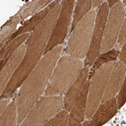 Immunohistochemical staining of human skeletal muscle shows moderate cytoplasmic positivity in myocytes.