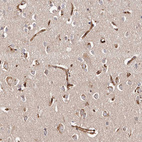 Anti-GTPBP1 Antibody