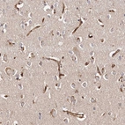 Immunohistochemical staining of human cerebral cortex shows moderate cytoplasmic positivity in endothelial cells.