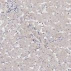 Immunohistochemical staining of human liver shows very weak positivity in hepatocytes.