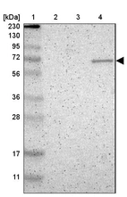 Lane 1: Marker [kDa] 230, 130, 95, 72, 56, 36, 28, 17, 11_br/_Lane 2: Human cell line RT-4_br/_Lane 3: Human cell line U-251MG sp_br/_Lane 4: Human plasma (IgG/HSA depleted)