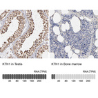 Anti-KTN1 Antibody