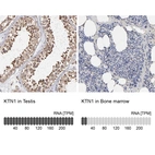 Anti-KTN1 Antibody