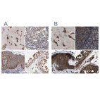 Immunohistochemical staining of human cerebral cortex, lymph node, skin and testis using Anti-KTN1 antibody HPA003178 (A) shows similar protein distribution across tissues to independent antibody HPA017876 (B).