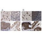 Immunohistochemical staining of human cerebral cortex, lymph node, skin and testis using Anti-KTN1 antibody HPA003178 (A) shows similar protein distribution across tissues to independent antibody HPA017876 (B).