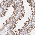 Anti-KTN1 Antibody