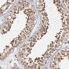 Immunohistochemical staining of human testis shows high expression.