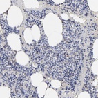 Anti-KTN1 Antibody