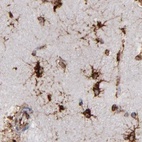 Anti-KTN1 Antibody