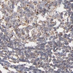 Immunohistochemical staining of human lymph node using Anti-KTN1 antibody HPA003178.