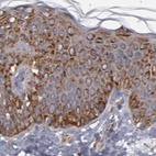 Immunohistochemical staining of human skin using Anti-KTN1 antibody HPA003178.