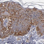Immunohistochemical staining of human skin using Anti-KTN1 antibody HPA003178.