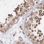 Anti-KTN1 Antibody