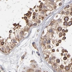 Immunohistochemical staining of human testis using Anti-KTN1 antibody HPA003178.