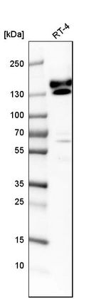 Western blot analysis in human cell line RT-4.