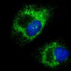 Anti-KTN1 Antibody