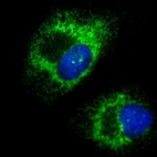 Immunofluorescent staining of human cell line U-251 MG shows localization to endoplasmic reticulum.