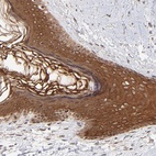 Anti-TNRC6B Antibody