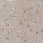 Anti-NLGN3 Antibody